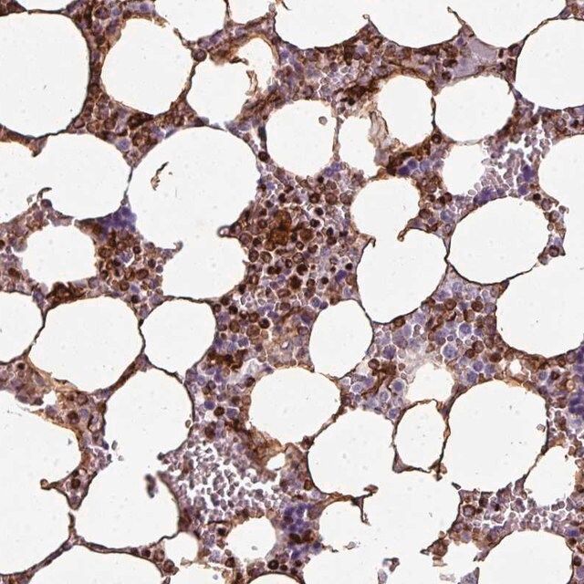 Anti-TMEFF1 antibody produced in rabbit