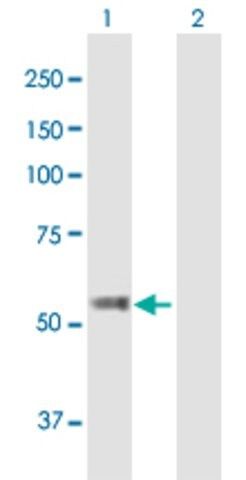Anti-TBC1D19 antibody produced in mouse