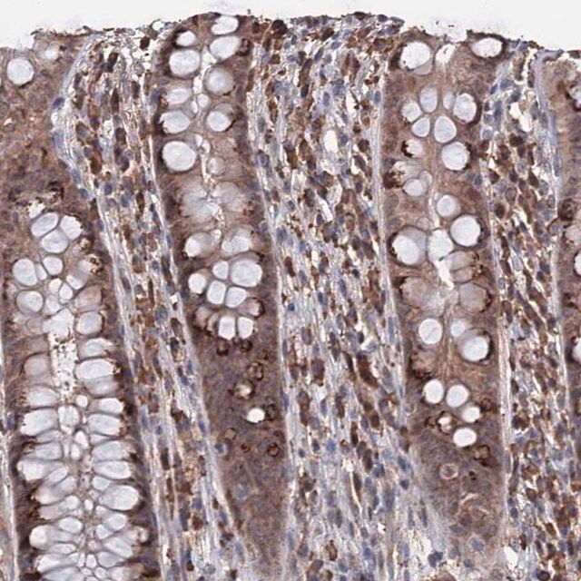 Anti-TBC1D12 antibody produced in rabbit
