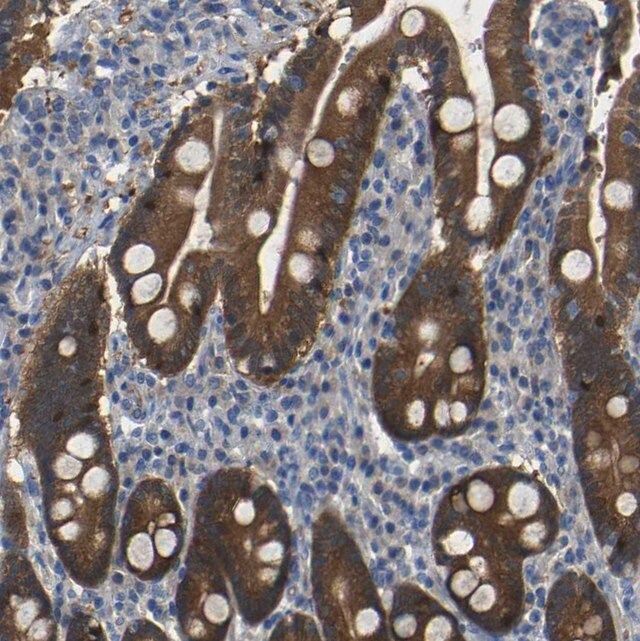 Anti-TBC1D32 antibody produced in rabbit