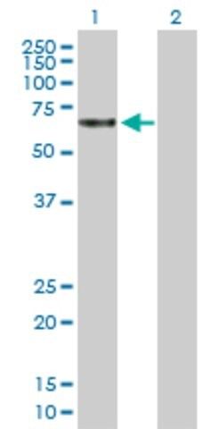Anti-TBCD antibody produced in mouse