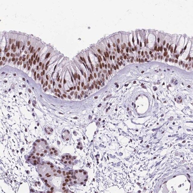 Anti-TBC1D26 antibody produced in rabbit