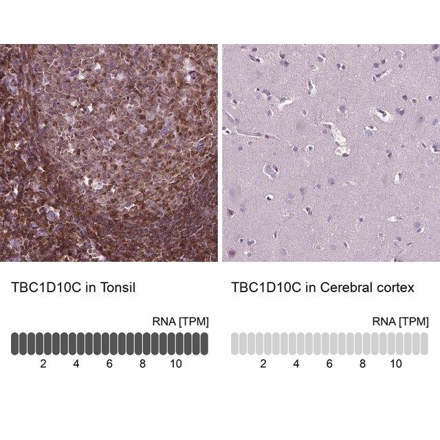 Anti-TBC1D10C antibody produced in rabbit