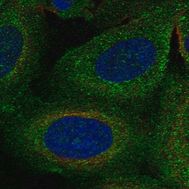 Anti-TBC1D2B antibody produced in rabbit