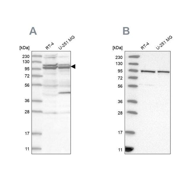 Anti-TBC1D5 antibody produced in rabbit