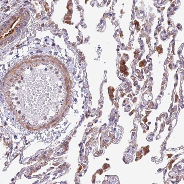 Anti-TBC1D20 antibody produced in rabbit