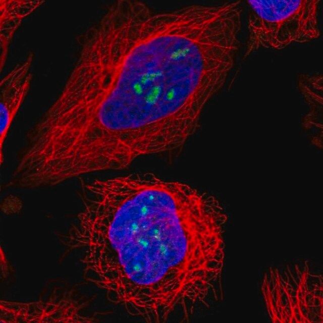 Anti-TBL3 antibody produced in rabbit