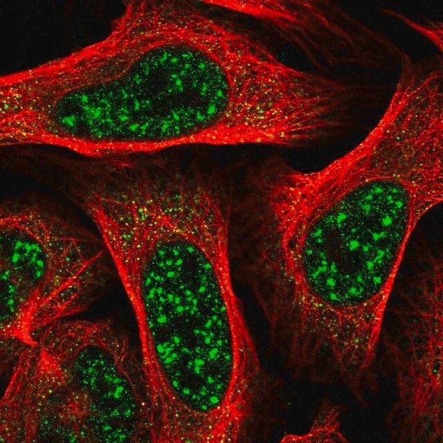 Anti-TBC1D8 antibody produced in rabbit