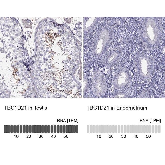 Anti-TBC1D21 antibody produced in rabbit
