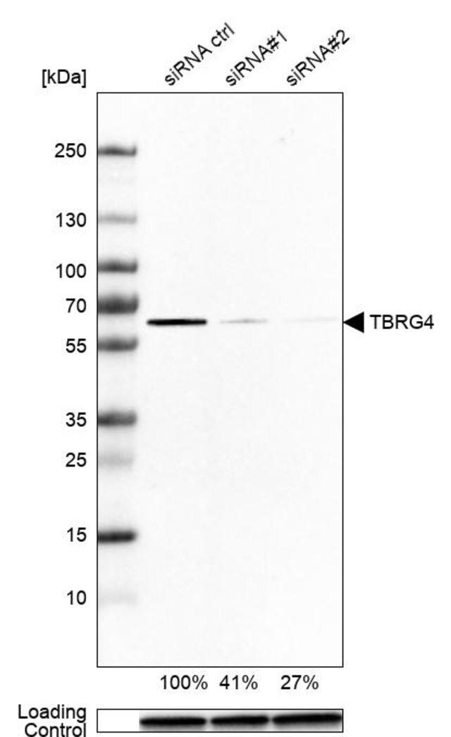 Anti-TBRG4 antibody produced in rabbit