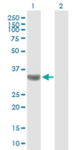 Anti-TBC1D3 antibody produced in mouse