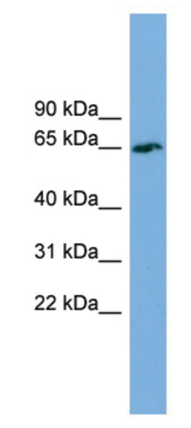 Anti-TBC1D24 antibody produced in rabbit