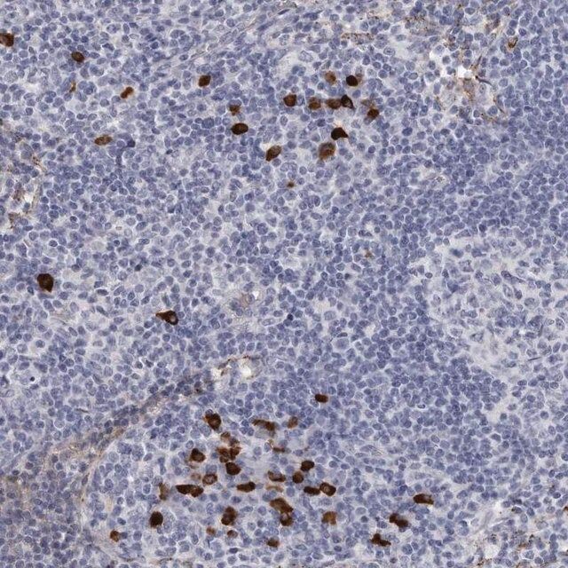 Anti-TBC1D22B antibody produced in rabbit