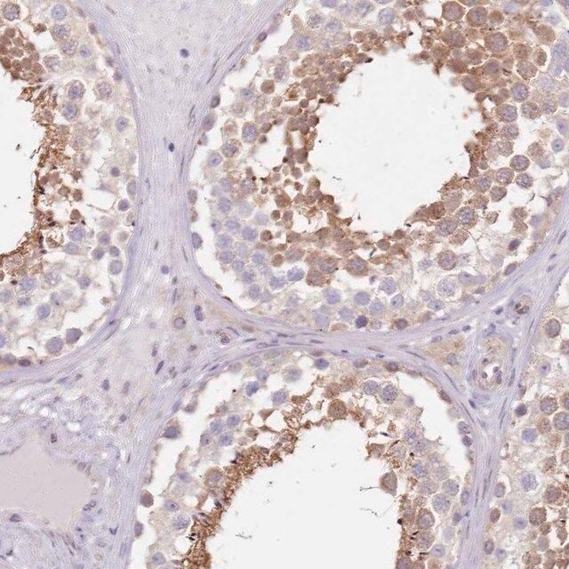 Anti-TBC1D9 antibody produced in rabbit