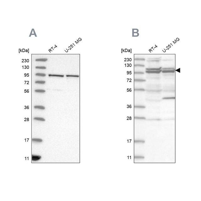Anti-TBC1D5 antibody produced in rabbit