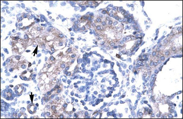 Anti-TBX19 antibody produced in rabbit