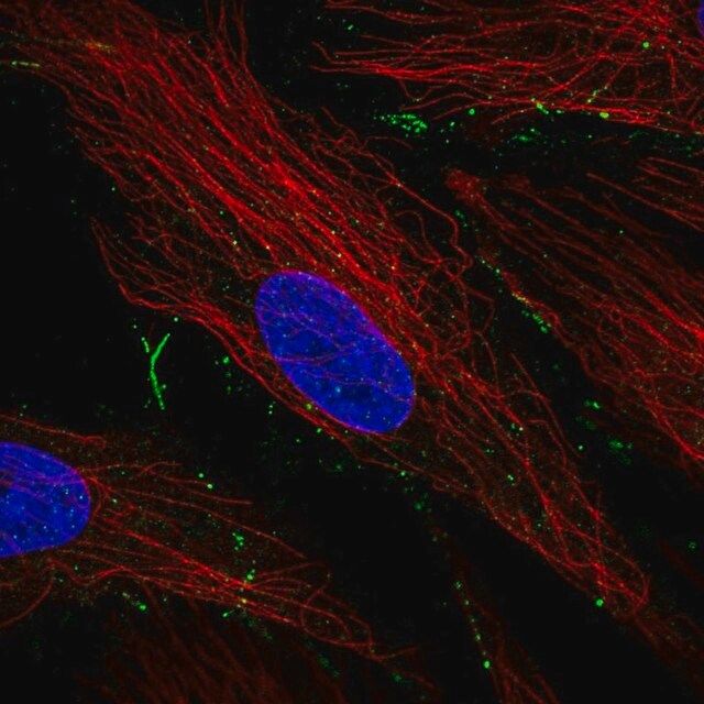 Anti-TBC1D24 antibody produced in rabbit
