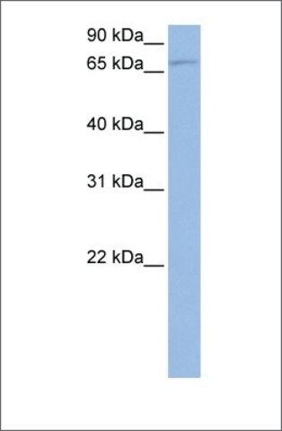 Anti-TBK1