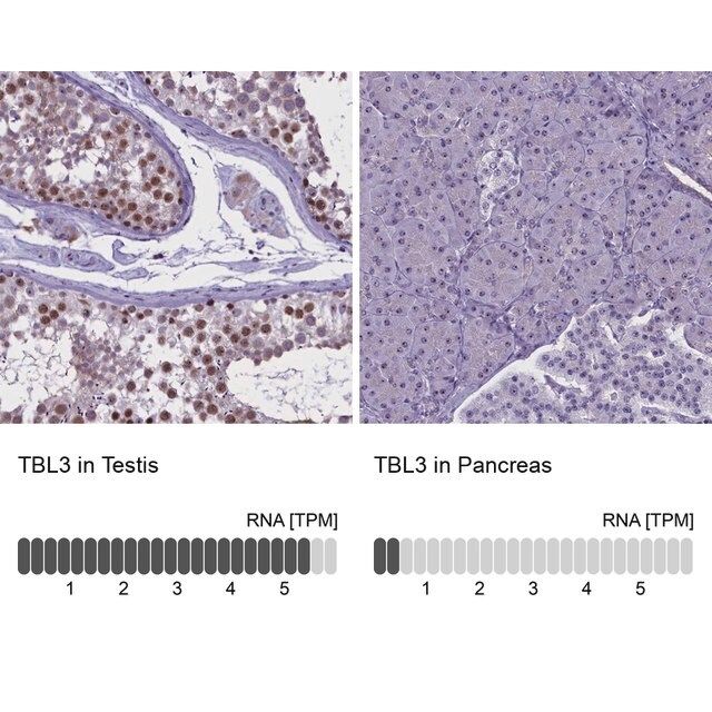 Anti-TBL3 antibody produced in rabbit