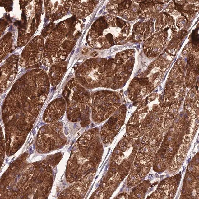 Anti-TBC1D24 antibody produced in rabbit