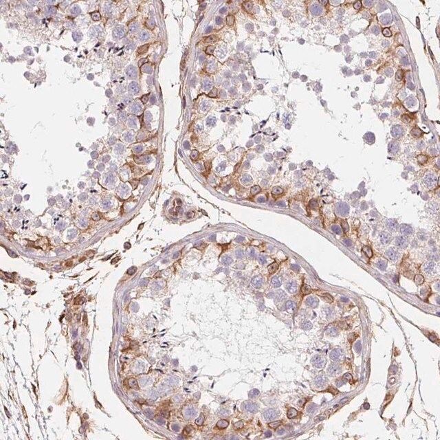 Anti-TBKBP1 antibody produced in rabbit