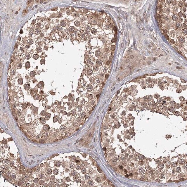 Anti-TBC1D23 antibody produced in rabbit