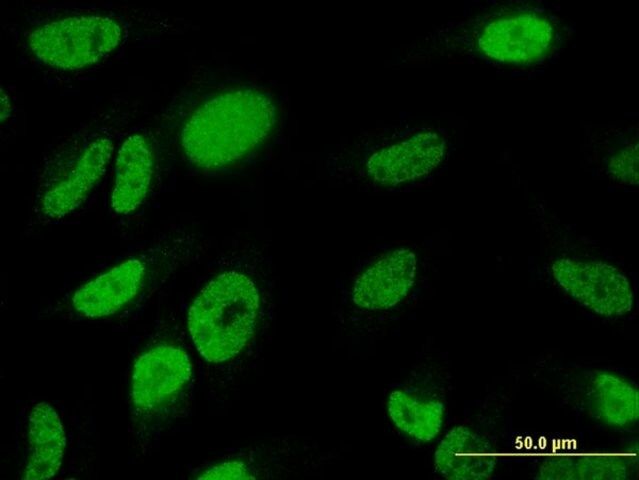 ANTI-TBX18 antibody produced in mouse