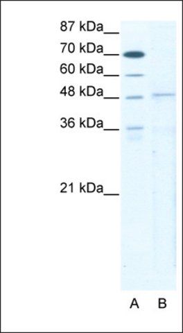 Anti-TBX5 antibody produced in rabbit