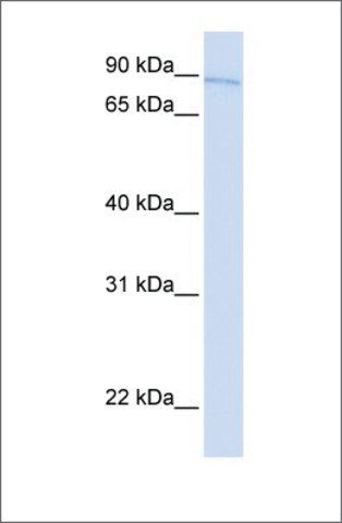 Anti-TBX2 antibody produced in rabbit