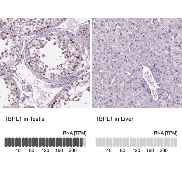 Anti-TBPL1 antibody produced in rabbit