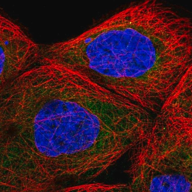 Anti-TBL2 antibody produced in rabbit