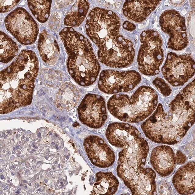 Anti-TBC1D30 antibody produced in rabbit