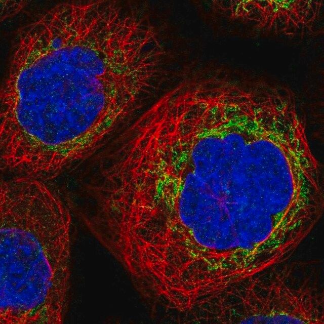 Anti-TBRG4 antibody produced in rabbit