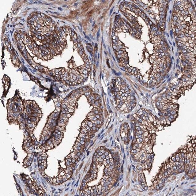 Anti-TBCEL antibody produced in rabbit