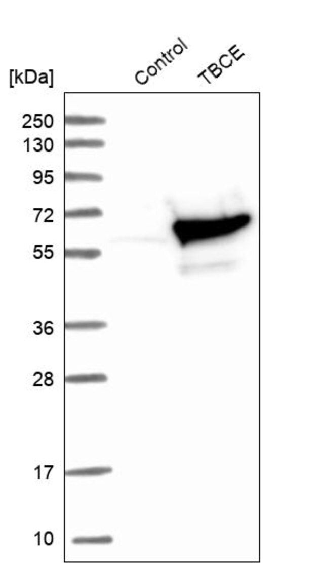Anti-TBCE antibody produced in rabbit