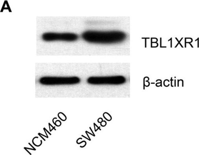 Anti-TBL1XR1 antibody produced in rabbit