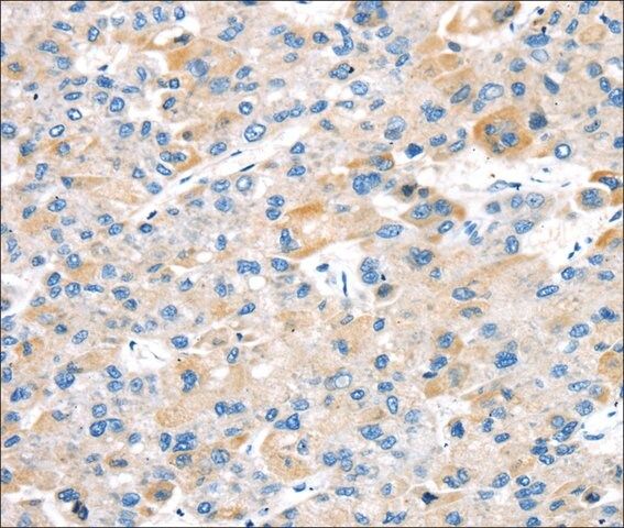 Anti-TBRG1