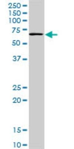 ANTI-TBX18 antibody produced in mouse
