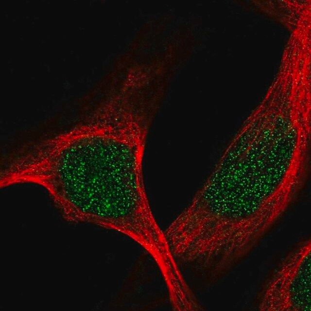 Anti-TBRG1 antibody produced in rabbit