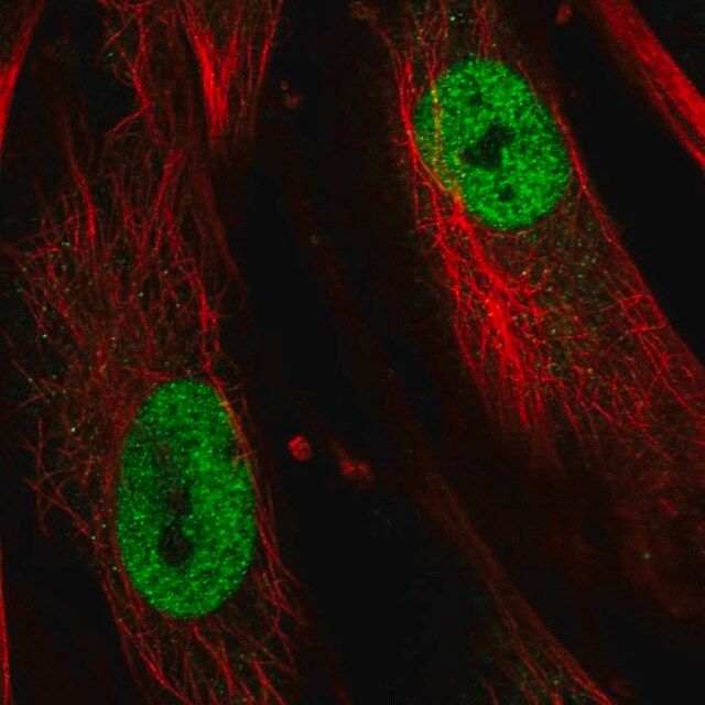 Anti-TBX5 antibody produced in rabbit