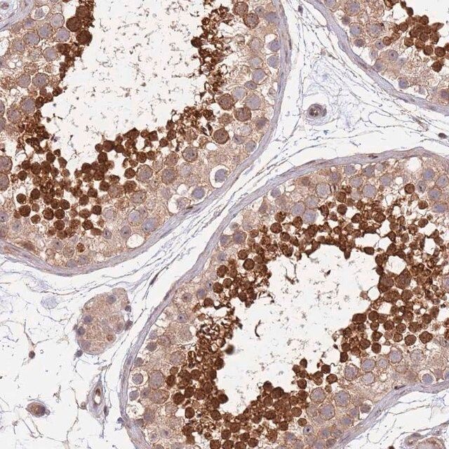 Anti-TBX10 antibody produced in rabbit