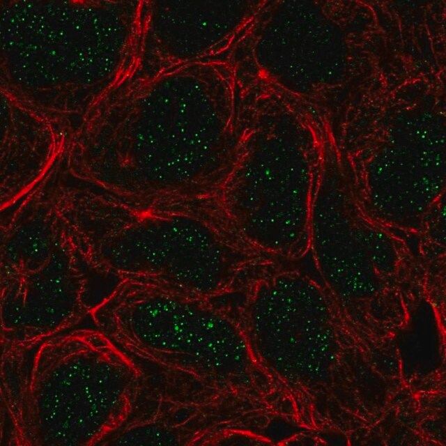 Anti-TBX6 antibody produced in rabbit