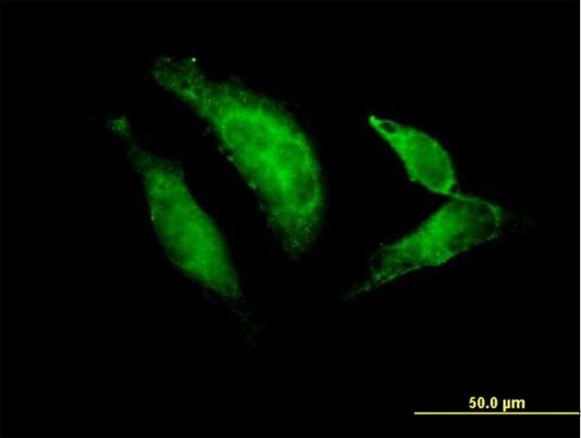 Anti-TBX20 antibody produced in mouse