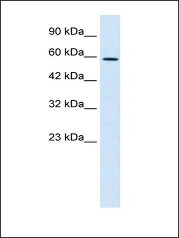 Anti-TBX4 antibody produced in rabbit