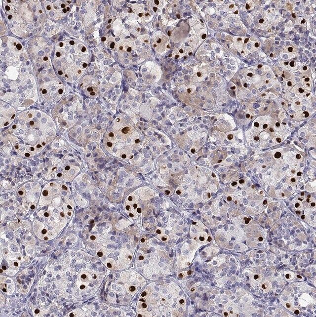 Anti-TBX19 antibody produced in rabbit