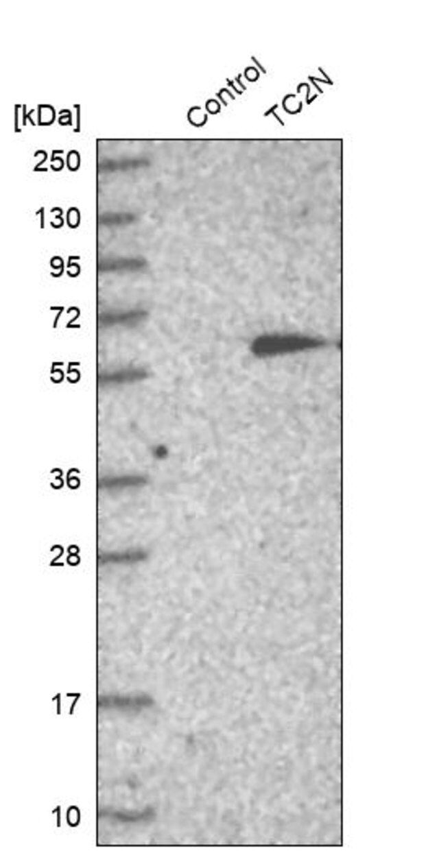 Anti-TC2N antibody produced in rabbit