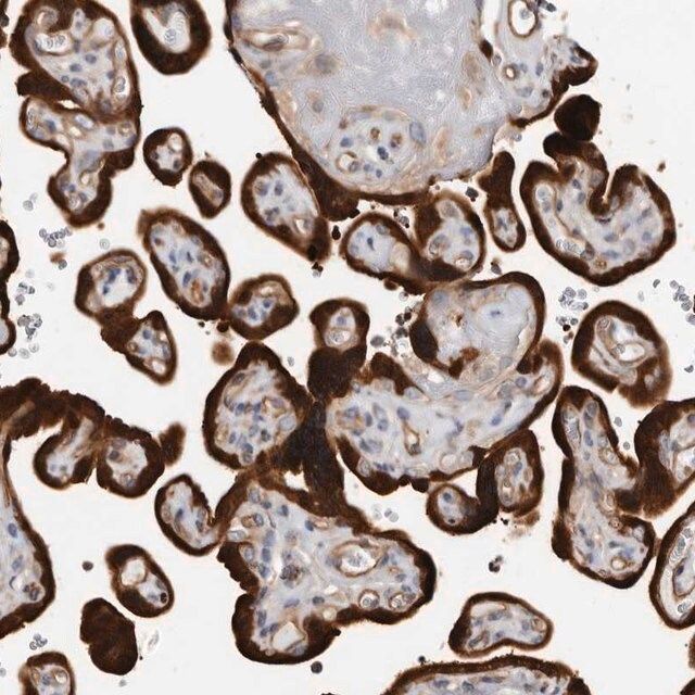 Anti-TCHH antibody produced in rabbit