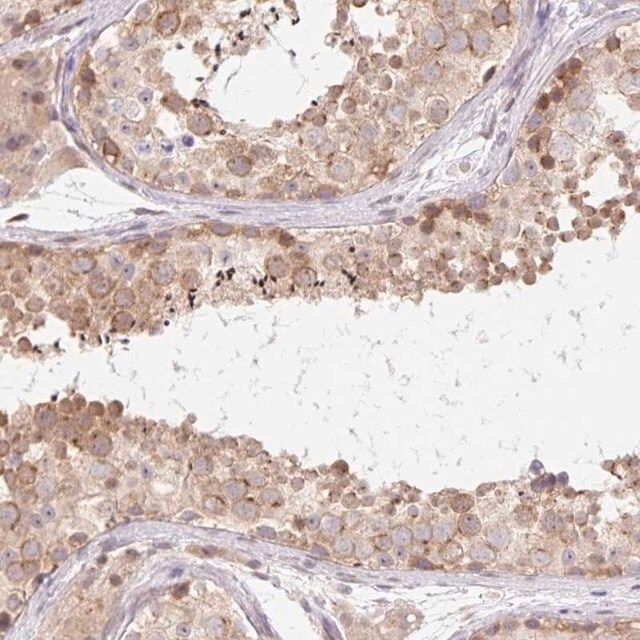 Anti-TBPL2 antibody produced in rabbit