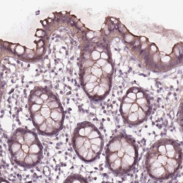 Anti-TCHP antibody produced in rabbit