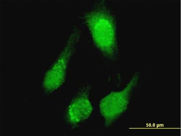 ANTI-TCL1A antibody produced in mouse